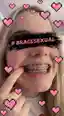 Bracesexual | brace caption - Image 1