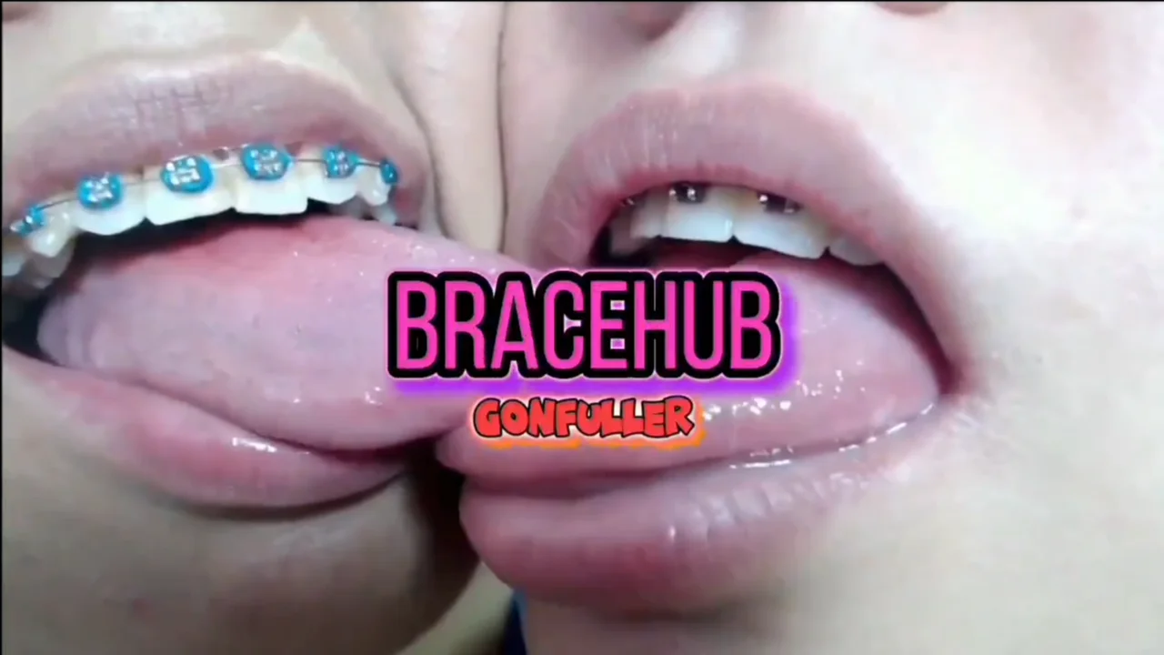 Braceface Goonfueller